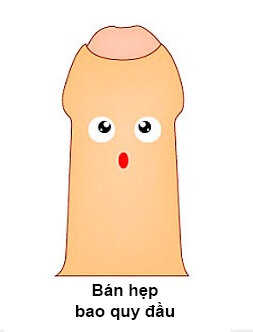 Bán hẹp bao quy đầu
